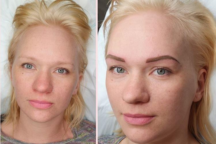 Губы сразу после перманентного макияжа фото до и после