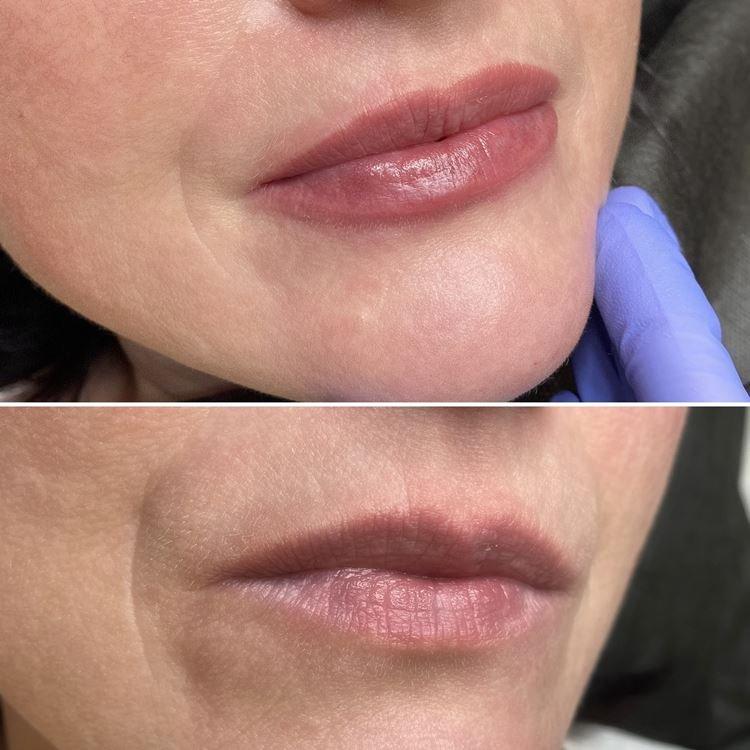 Перманентный макияж губ - фото до и после