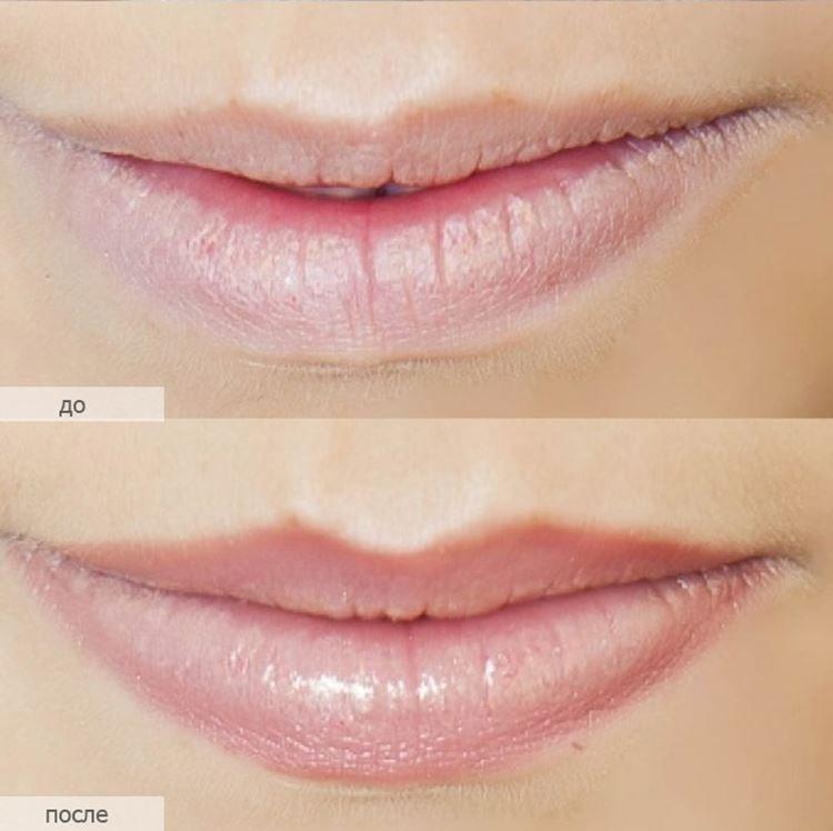 Перманентный макияж губ - фото до и после